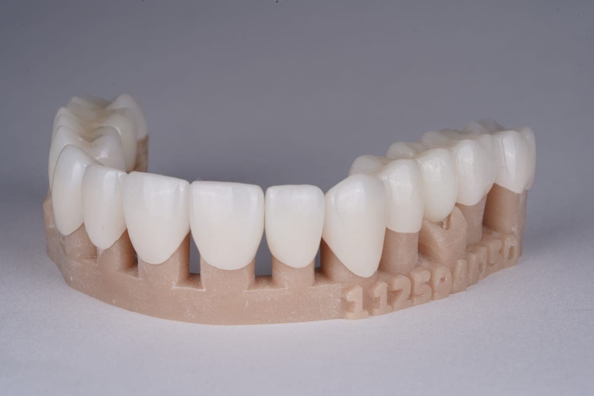Dental Crowns
