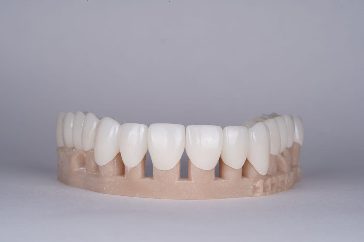 Dental Crowns procedure — AK Ultimate Dental, Las Vegas
