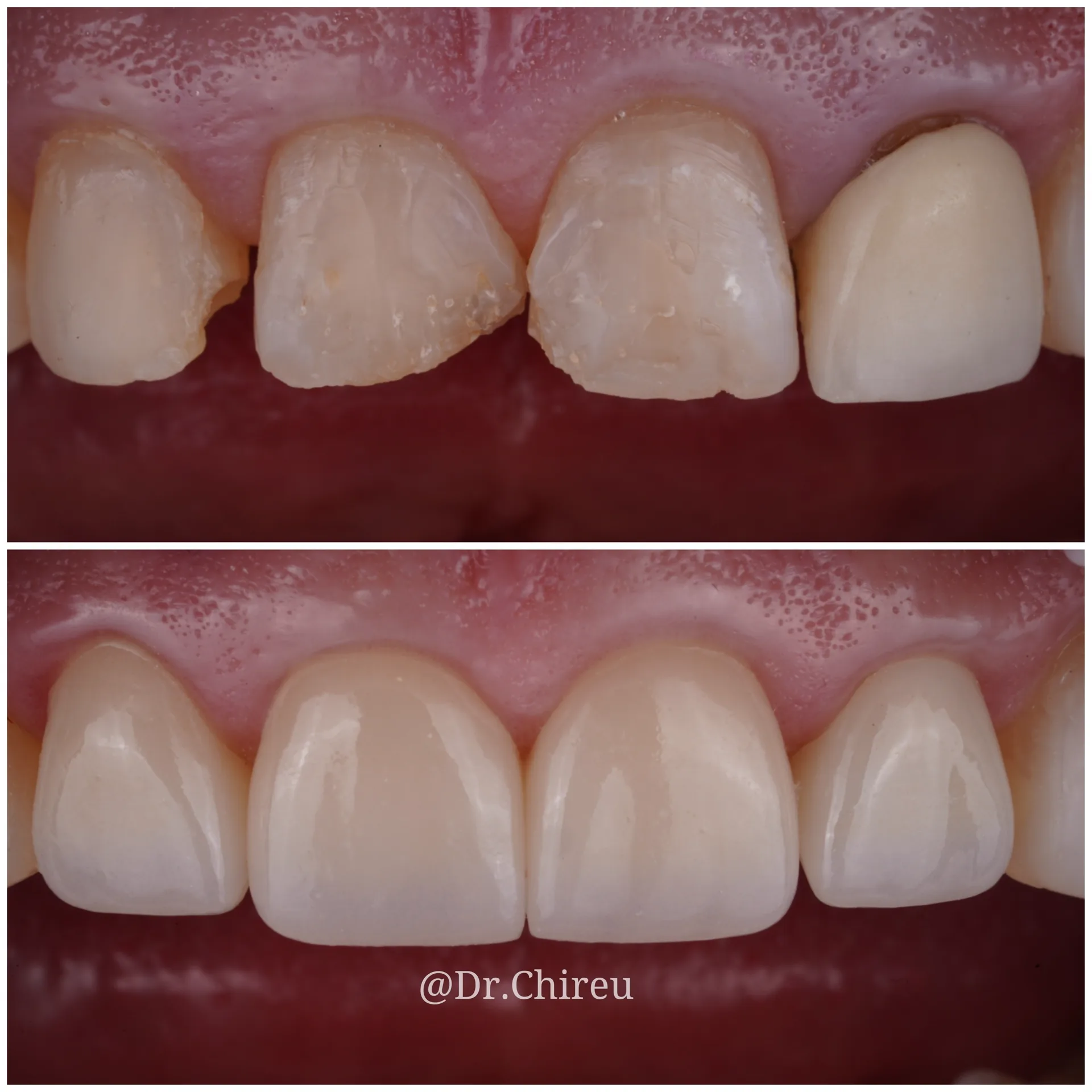Cosmetic Dentistry