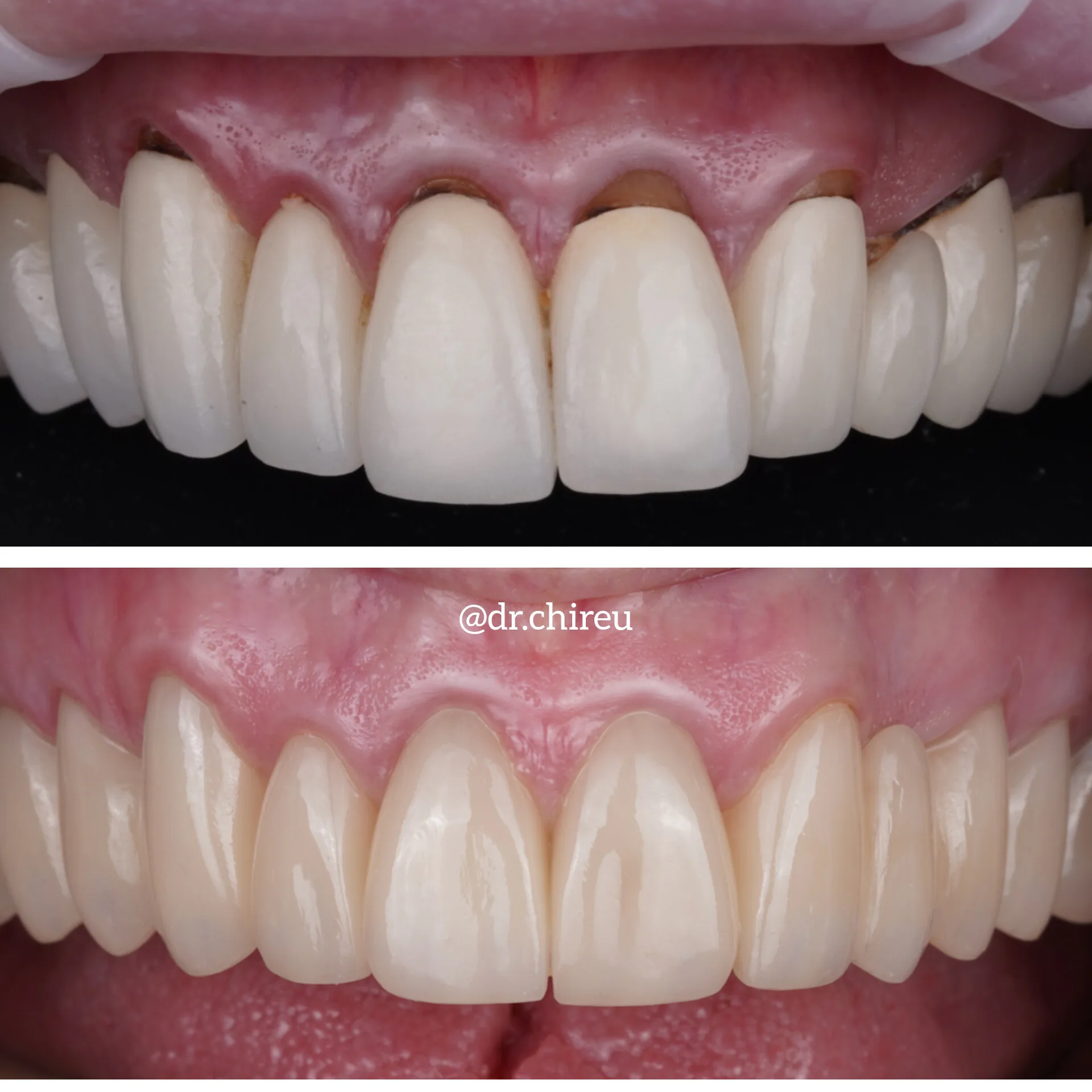 Cosmetic case photography from AK Ultimate Dental, Las Vegas