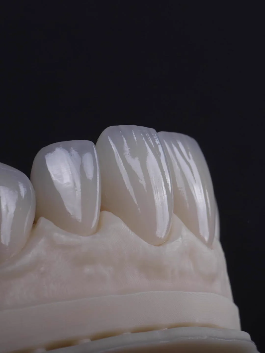Close-up macro of porcelain veneers — ceramic detail by Dr. Alex Chireau DMD Las Vegas