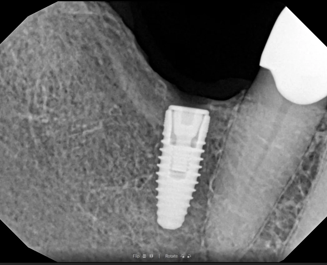 Cosmetic dentistry case work at AK Ultimate Dental, Las Vegas